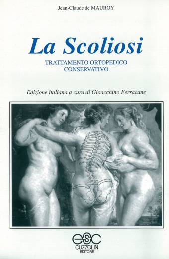 La scoliosi - Trattamento ortopedico conservativo