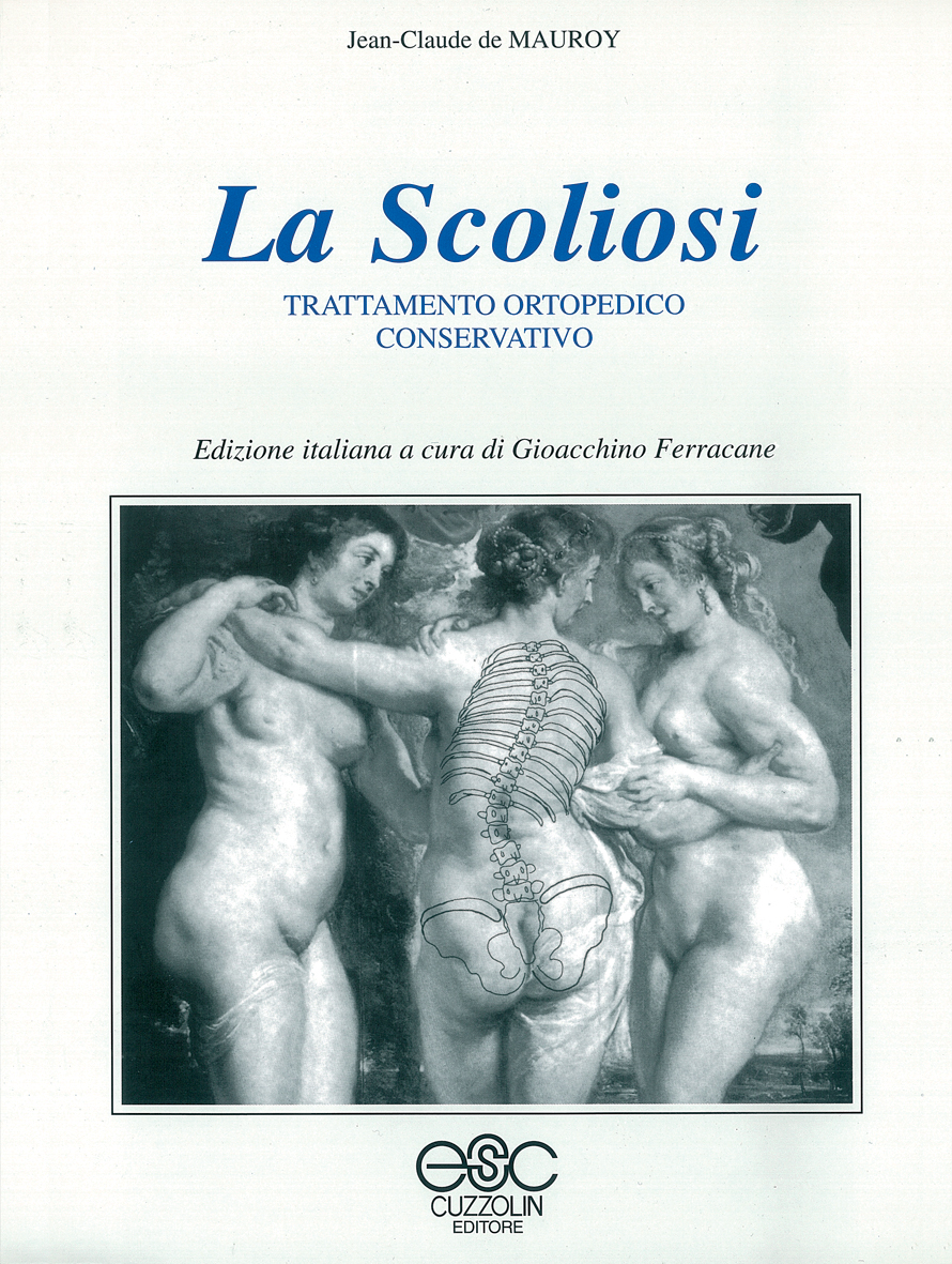 La scoliosi - Trattamento ortopedico conservativo